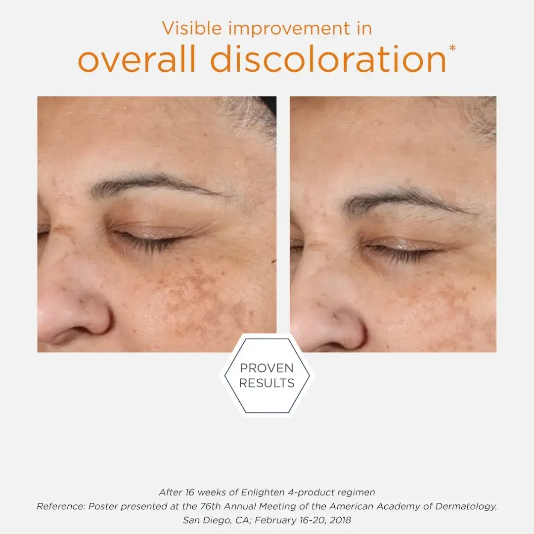 Selected image for NEOSTRATA Gel krema za lice protiv hiperpigmentacije Enlighten Pigment Controller 50 ml