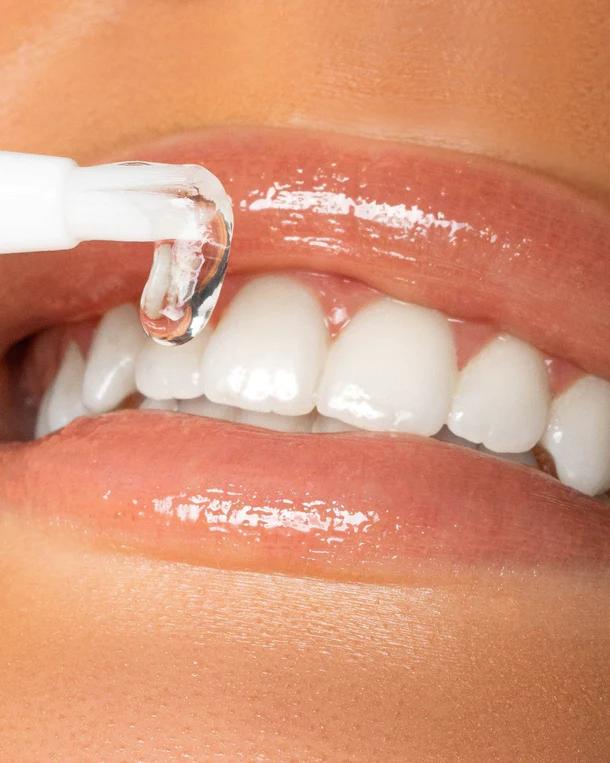 Selected image for SMILE KIT Olovka za izbeljivanje zuba 2ml