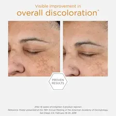 2 thumbnail image for NEOSTRATA Gel krema za lice protiv hiperpigmentacije Enlighten Pigment Controller 50 ml