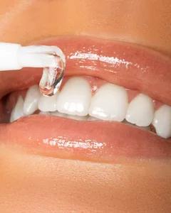 1 thumbnail image for SMILE KIT Olovka za izbeljivanje zuba 2ml