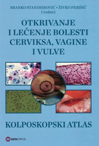 Otkrivanje i lečenje bolesti cerviksa, vagine i vulve - Kolposkopski atlas - Branko Stanimirović, Živko Perišić